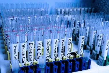 provette per analisi acque